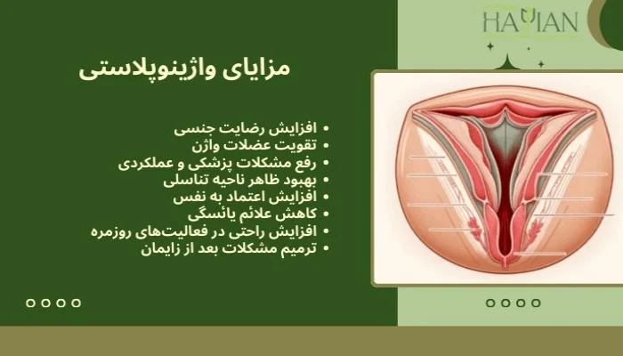 مزایای واژینوپلاستی