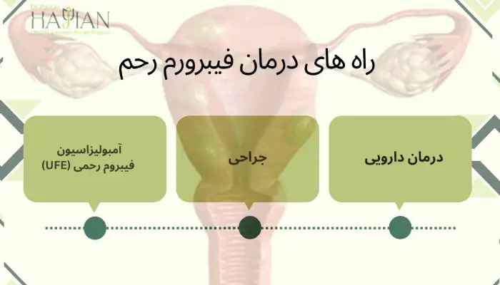 راه های درمان فیبرورم رحم