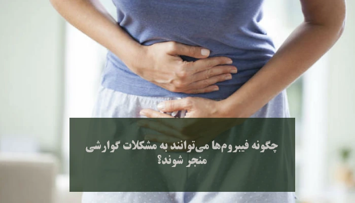 ارتباط فیبروم و مشکلات گوارشی