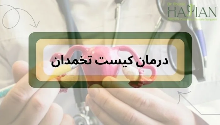 درمان کیست تخمدان چیست