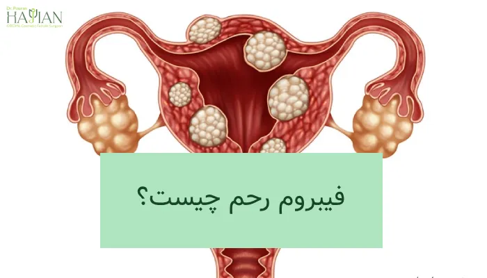 فیبروم رحم چیست؟