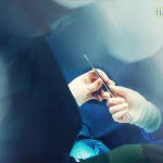 متخصص لابیاپلاستی