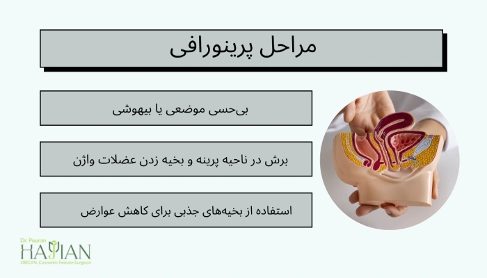 مراحل پرینورافی