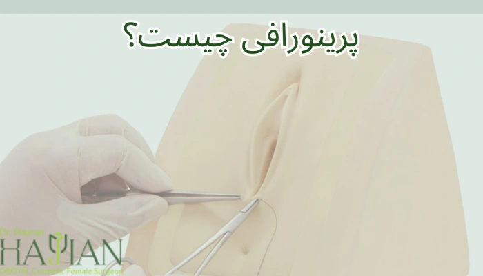 پرینورافی چیست؟