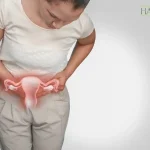 ترکیدن فیبروم رحم