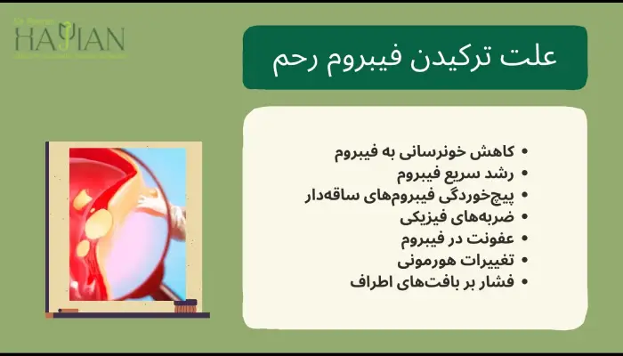 علت ترکیدن فیبروم رحم چیست