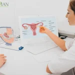 فیبروم ساب موکوزال