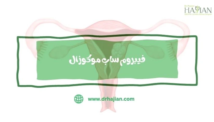 فیبروم ساب موکوزال چیست؟