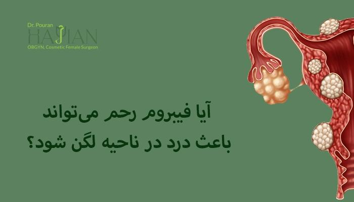 آیا فیبروم رحم می‌تواند باعث درد در ناحیه لگن شود؟