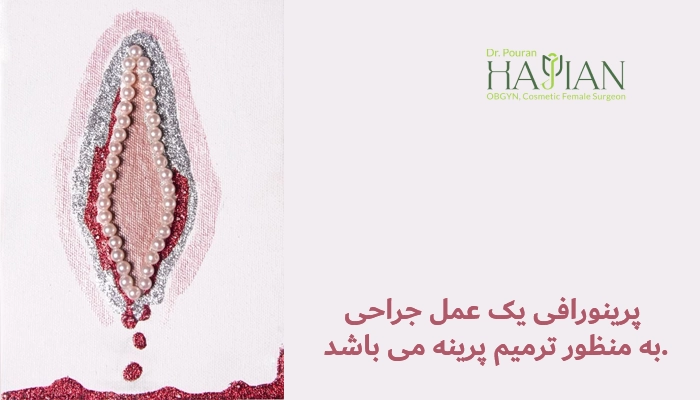 پرینورافی
