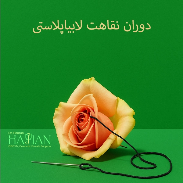 دوران نقاهت لابیاپلاستی