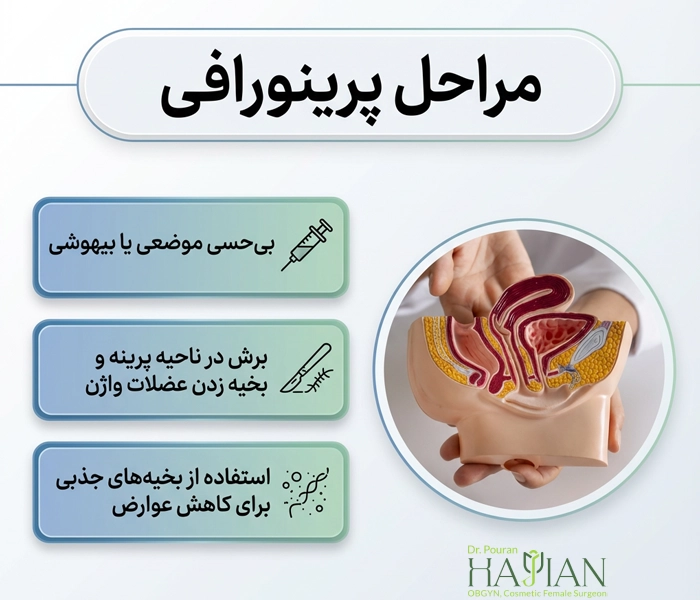 مراحل پرینورافی