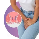 خونریزی بعد از عمل افتادگی مثانه