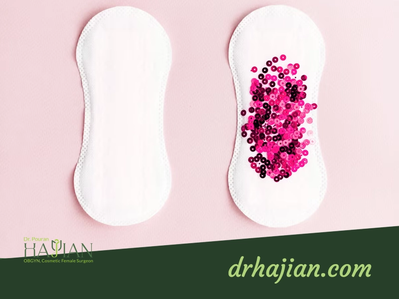 دفع فیبروم در پریودی
