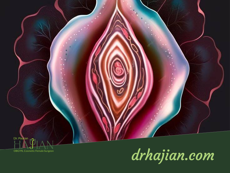 بهترین دکتر لابیاپلاستی