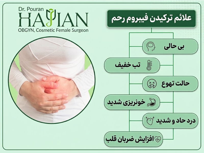 علائم ترکیدن فیبروم رحم
